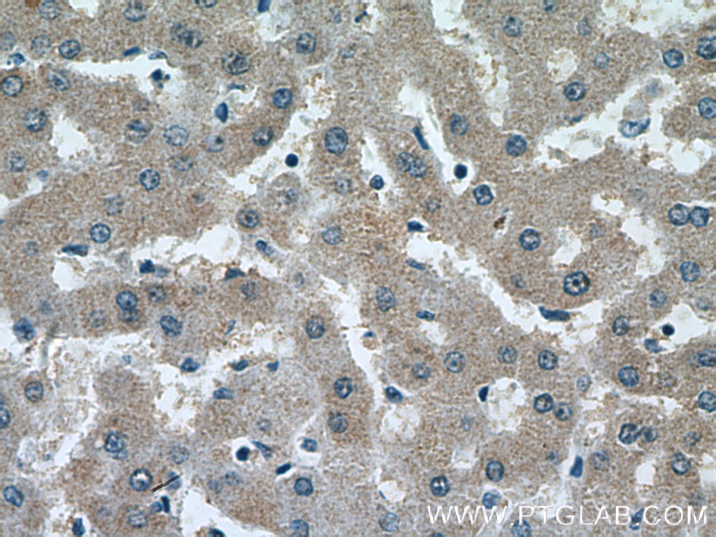 IHC staining of human liver using 66329-1-Ig (same clone as 66329-1-PBS)