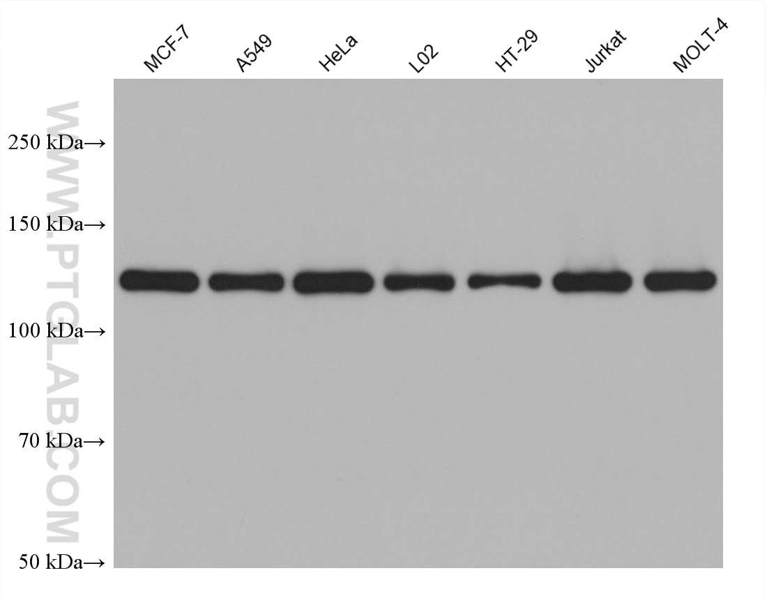 WB analysis using 66875-1-Ig (same clone as 66875-1-PBS)