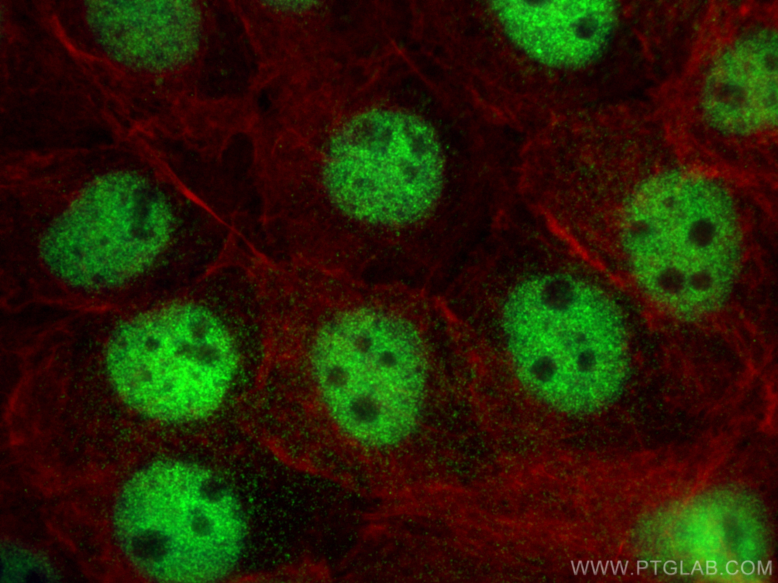 IF Staining of A431 using 16821-1-AP