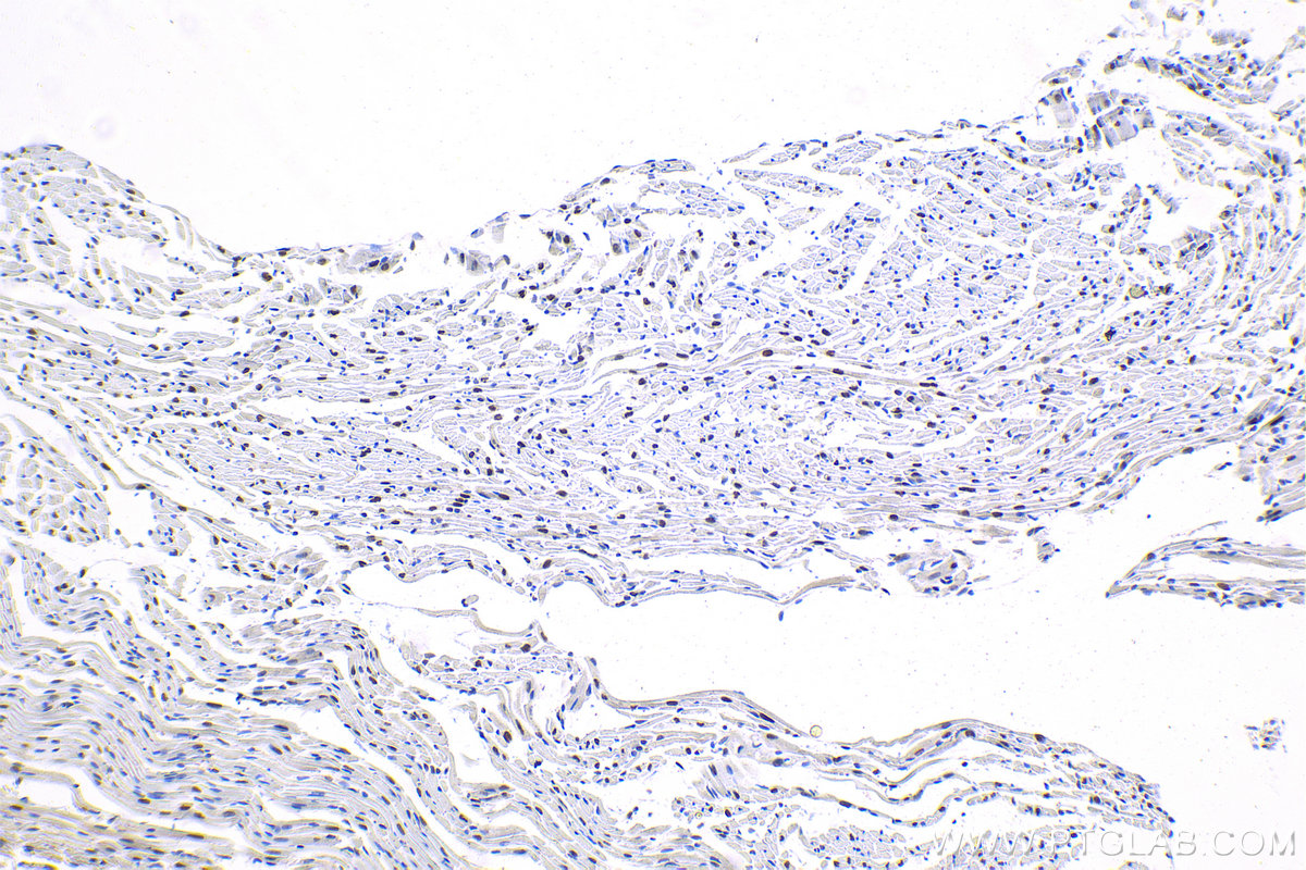 IHC staining of mouse heart using 16821-1-AP