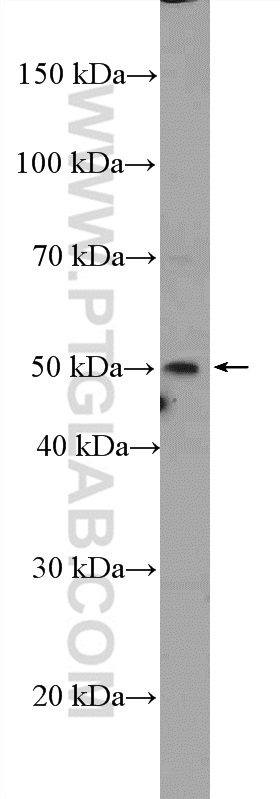 WB analysis of mouse heart using 12792-1-AP