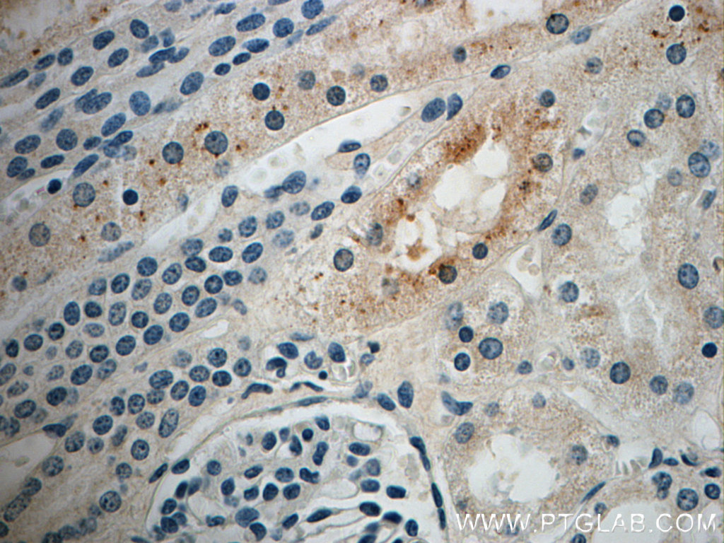 IHC staining of human kidney using 22519-1-AP