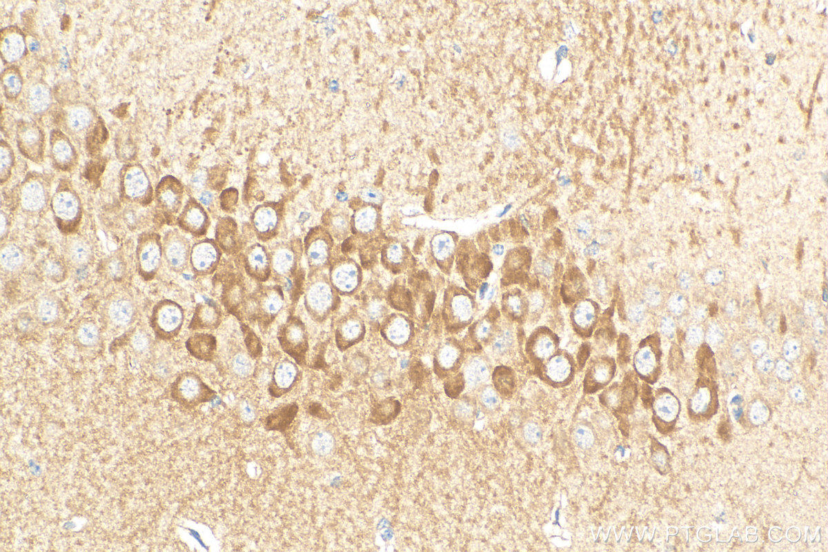 IHC staining of mouse brain using 22519-1-AP