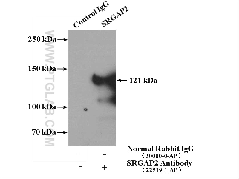 IP experiment of HEK-293 using 22519-1-AP