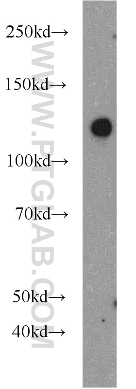 WB analysis of mouse kidney using 22519-1-AP