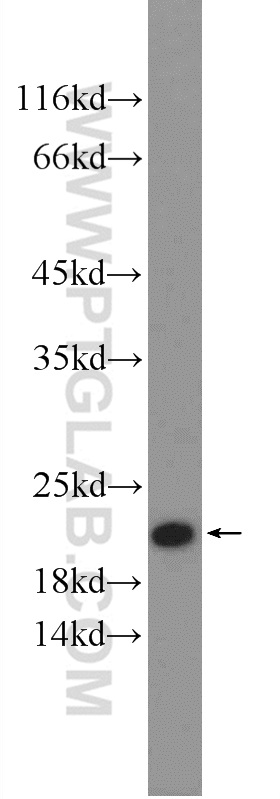 WB analysis of mouse liver using 16471-1-AP