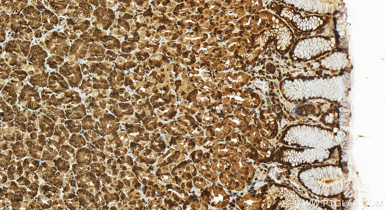 IHC staining of human stomach using 16033-1-AP