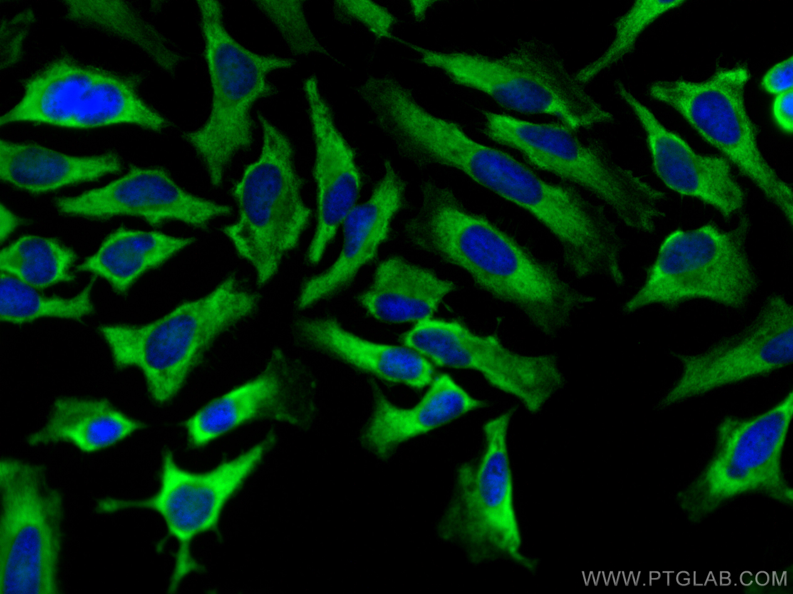 IF Staining of HeLa using 16033-1-AP