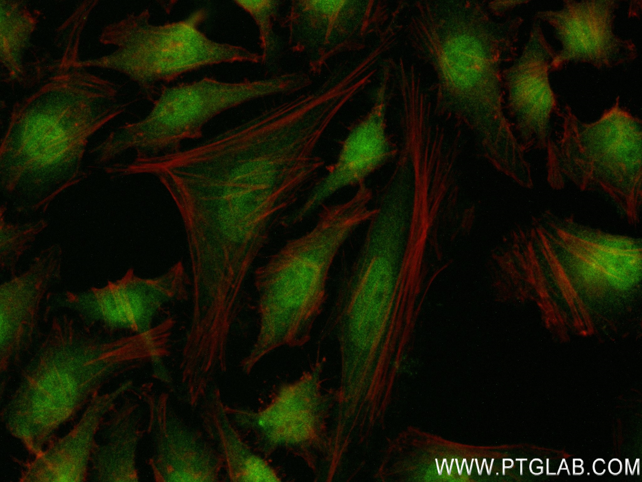 IF Staining of HeLa using 84061-3-RR (same clone as 84061-3-PBS)