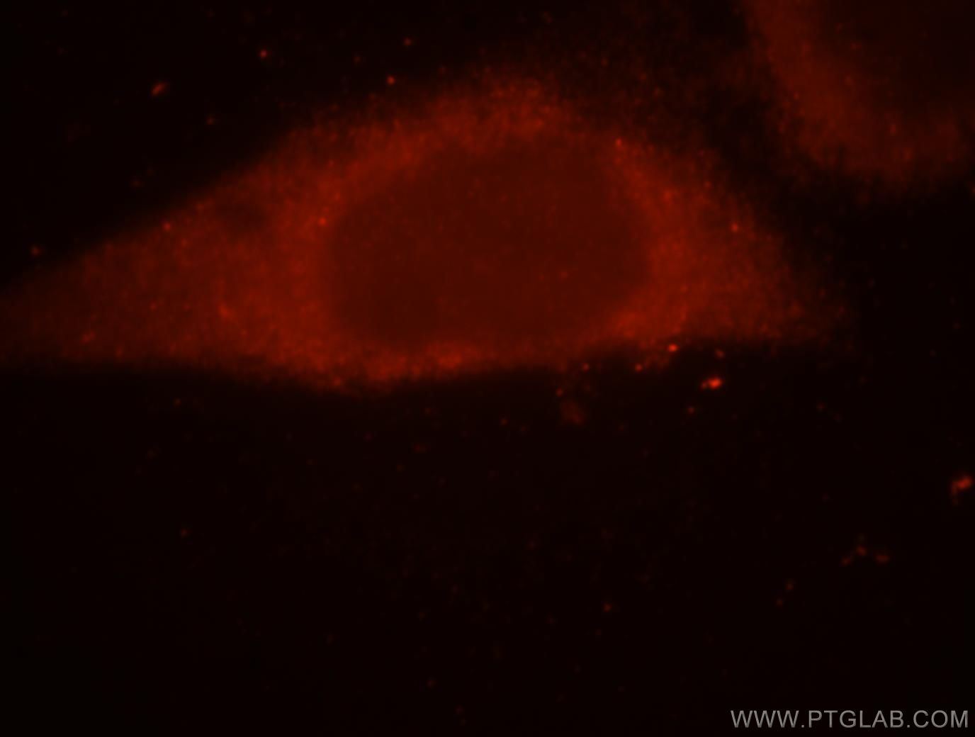 IF Staining of HepG2 using 17976-1-AP