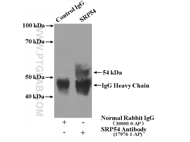 IP experiment of HeLa using 17976-1-AP