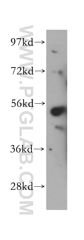 WB analysis of HeLa using 17976-1-AP