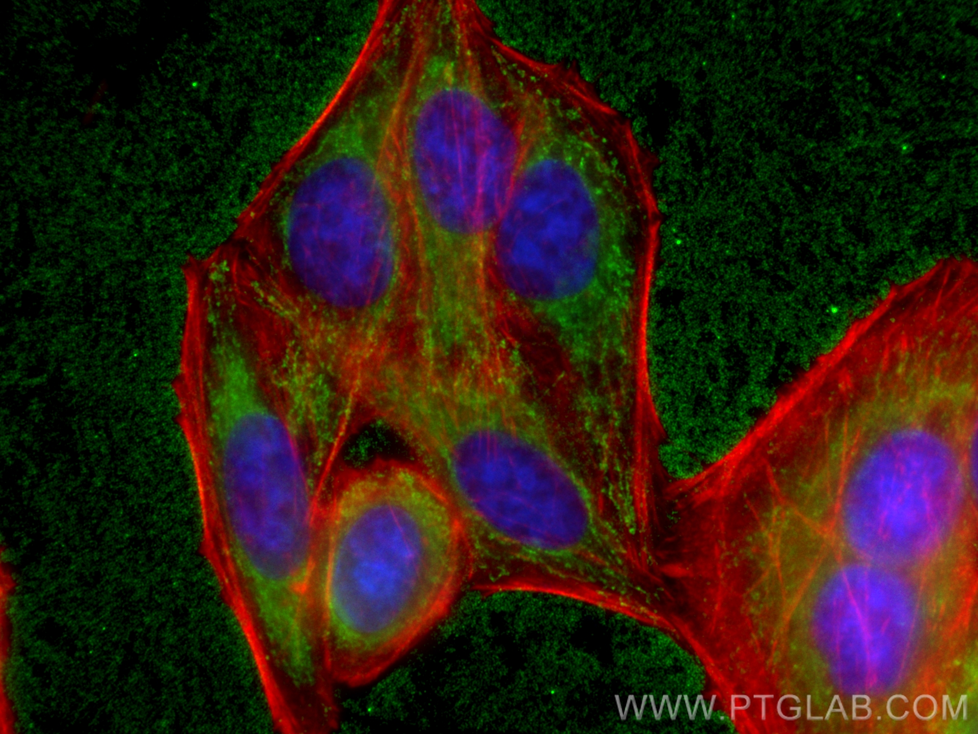 IF Staining of HepG2 using 67005-1-Ig (same clone as 67005-1-PBS)