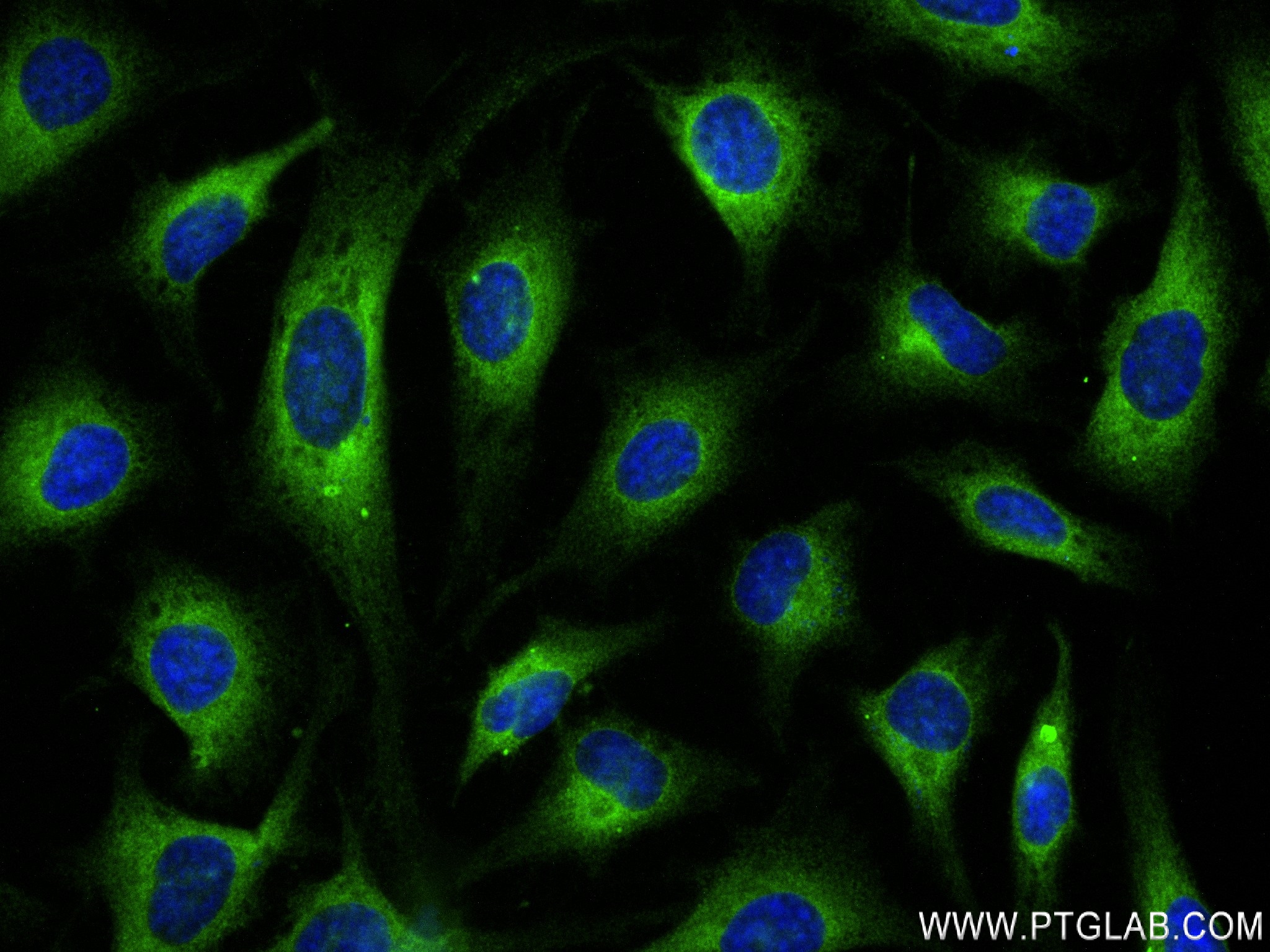 IF Staining of HeLa using 84014-5-RR