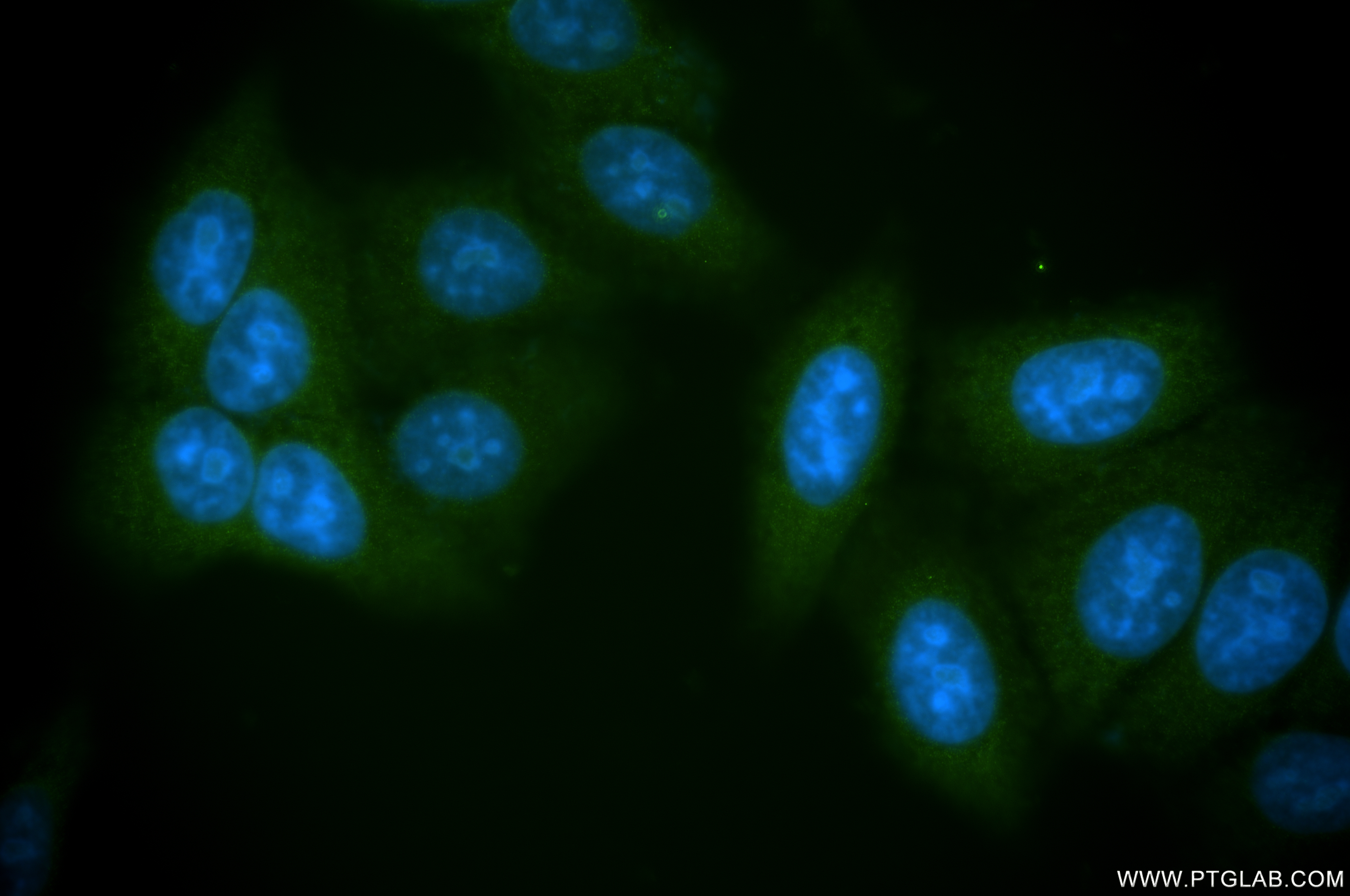 IF Staining of HepG2 using 84014-6-RR (same clone as 84014-6-PBS)