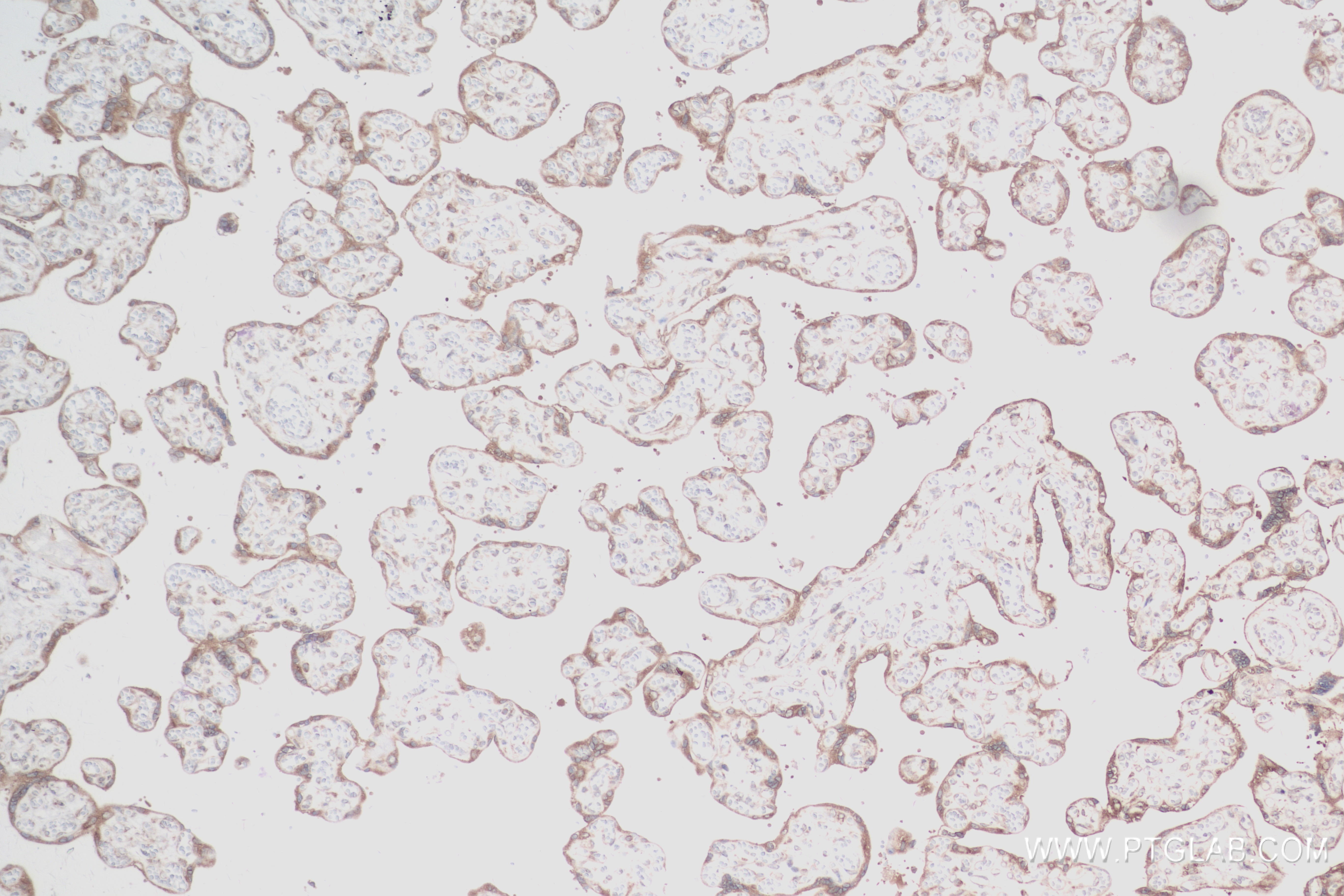 IHC staining of human placenta using 84014-6-RR (same clone as 84014-6-PBS)