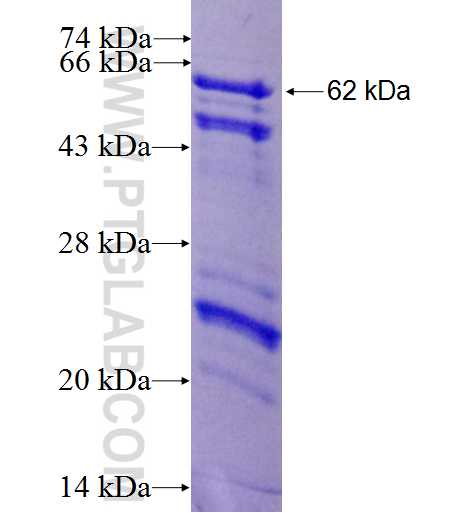 SRP68 fusion protein Ag2177 SDS-PAGE