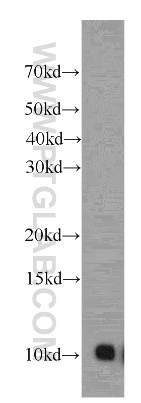 WB analysis of HepG2 using 11195-1-AP