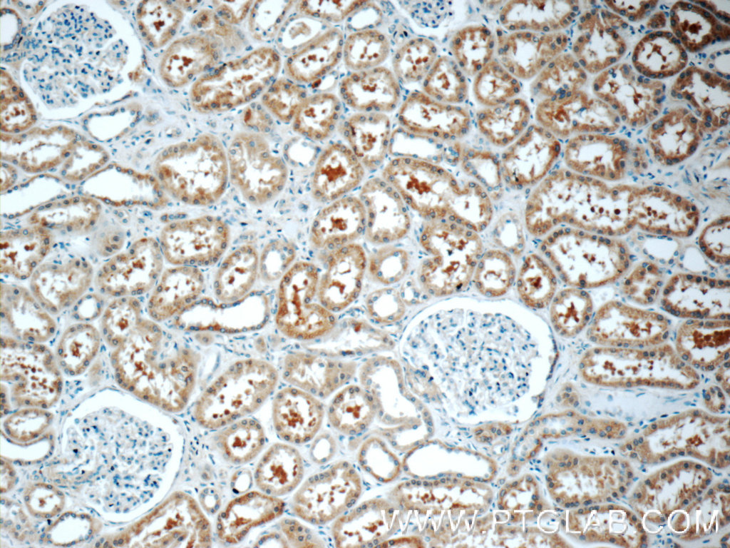 IHC staining of human kidney using 17955-1-AP