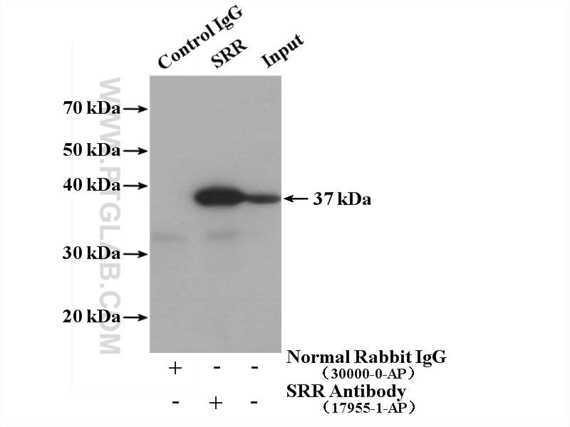 IP experiment of mouse brain using 17955-1-AP