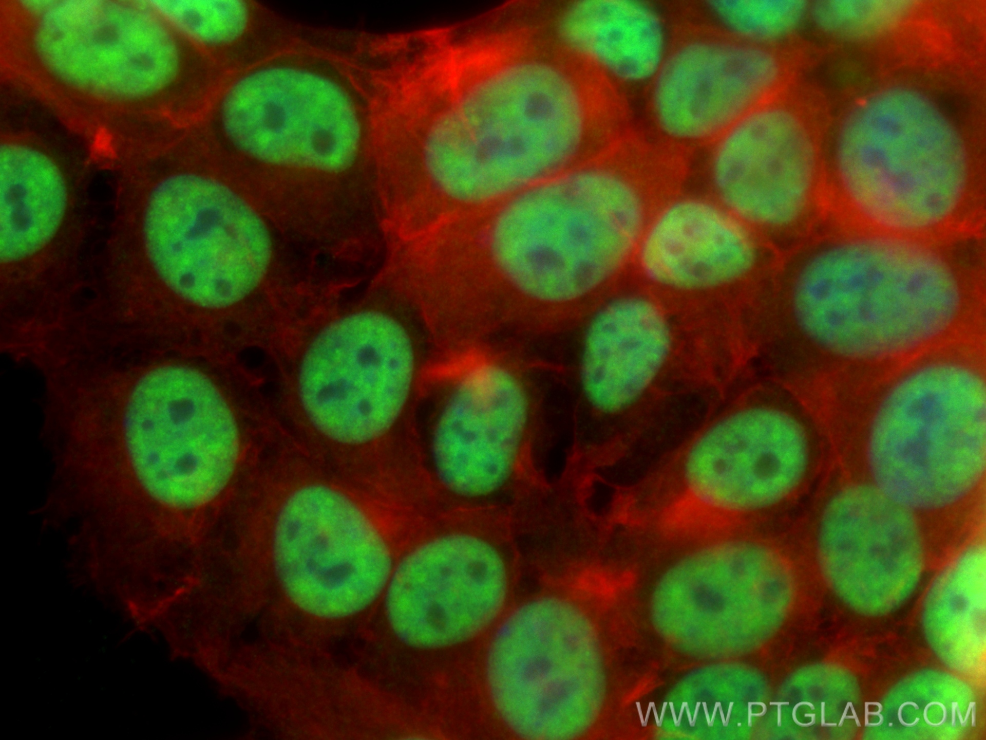 IF Staining of MCF-7 using 20353-1-AP