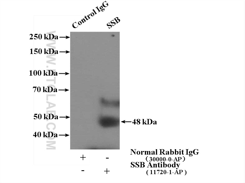 IP experiment of Jurkat using 11720-1-AP