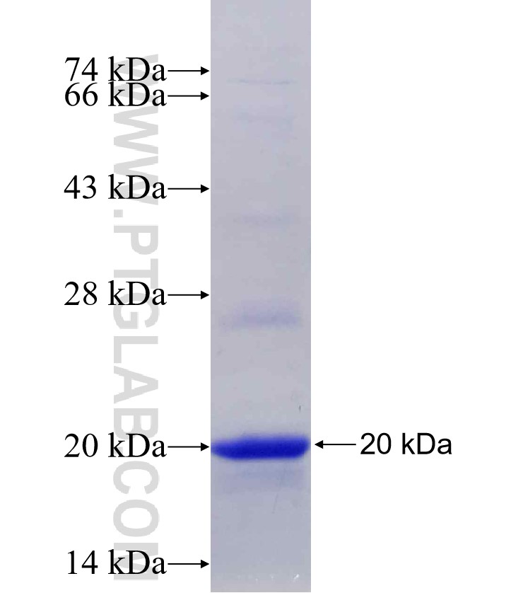 SSBP1 fusion protein Ag29976 SDS-PAGE