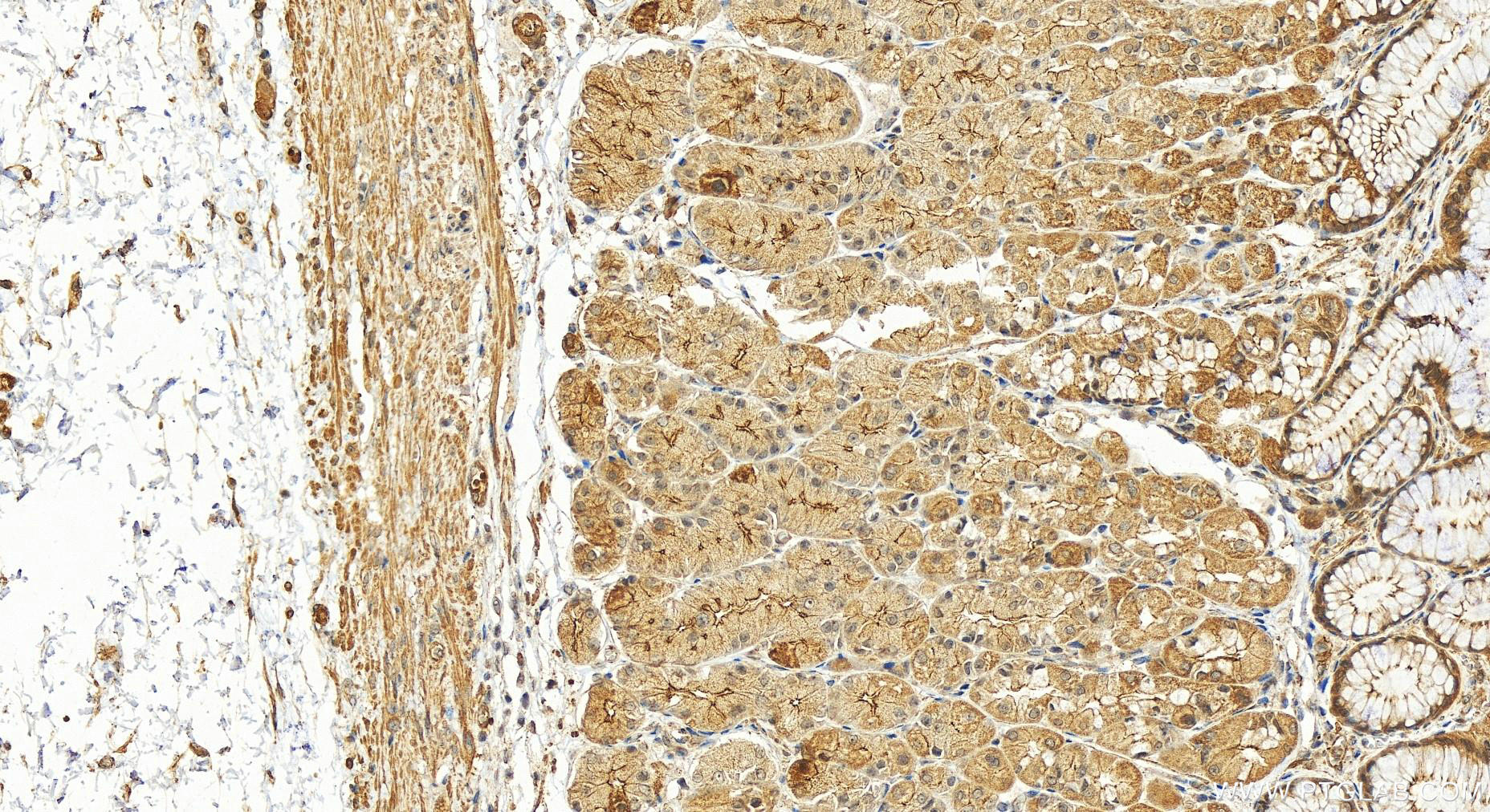 IHC staining of human stomach using 14157-1-AP