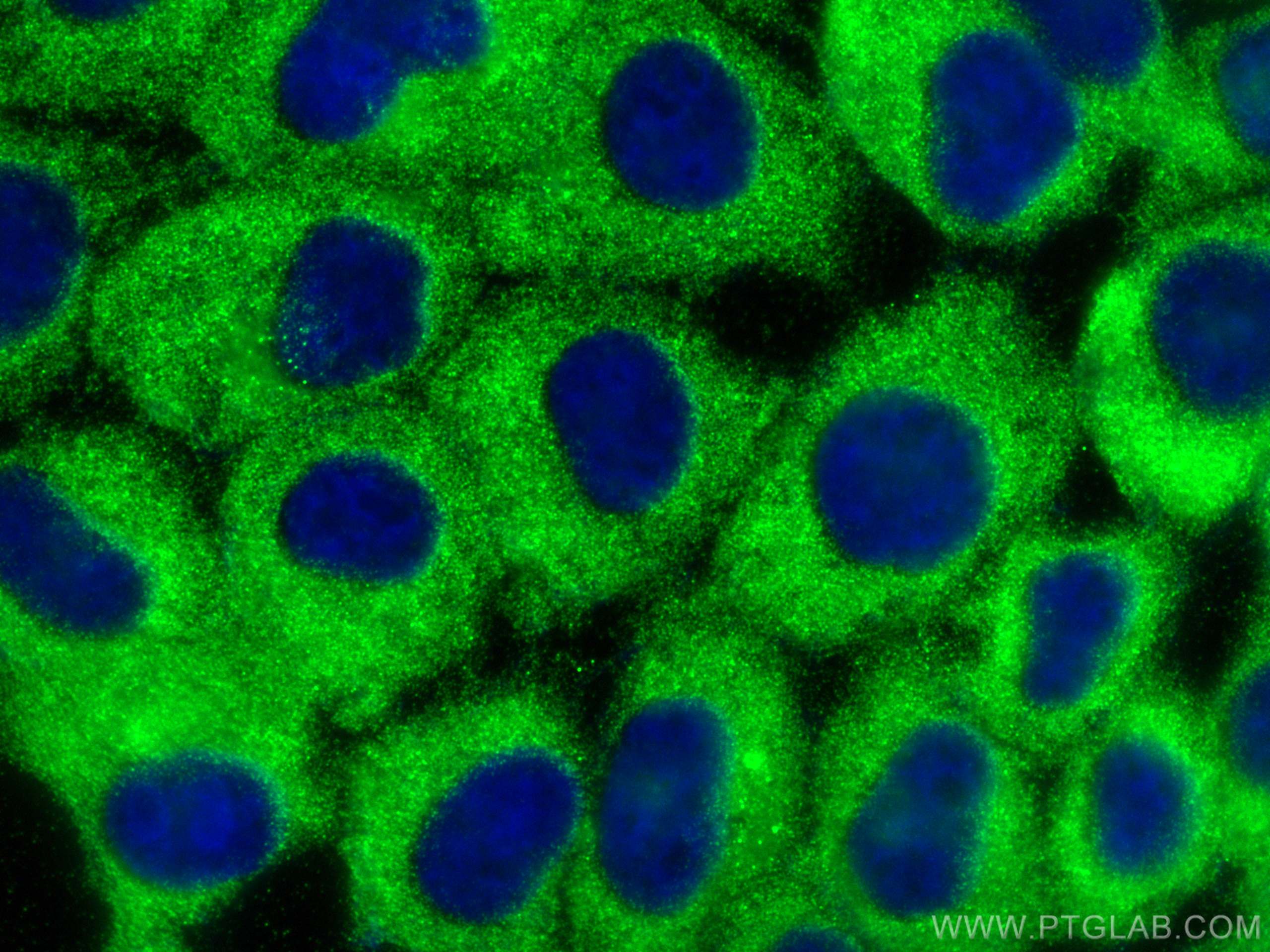 IF Staining of A431 using 18324-1-AP