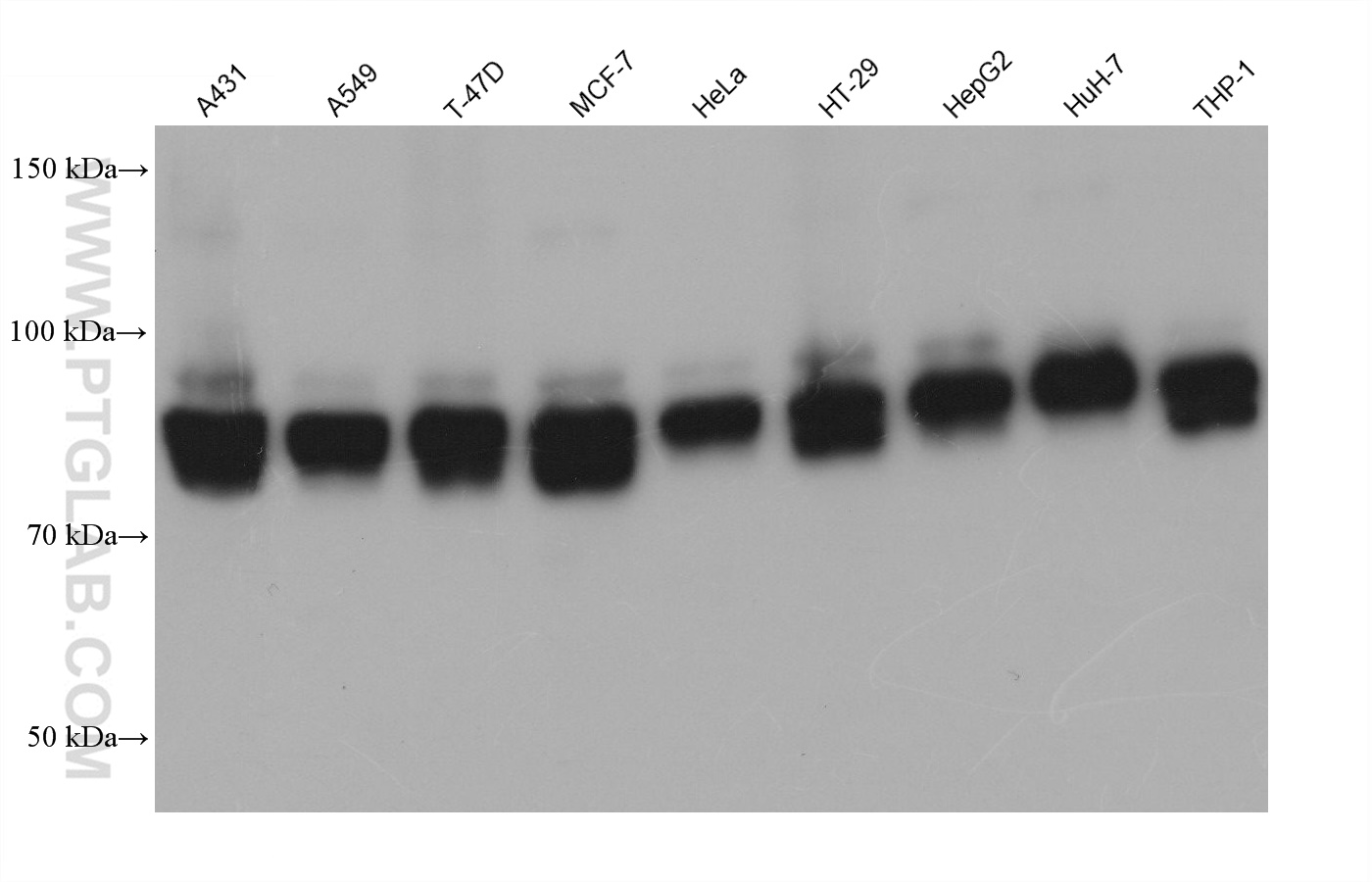 WB analysis using 68583-1-Ig (same clone as 68583-1-PBS)