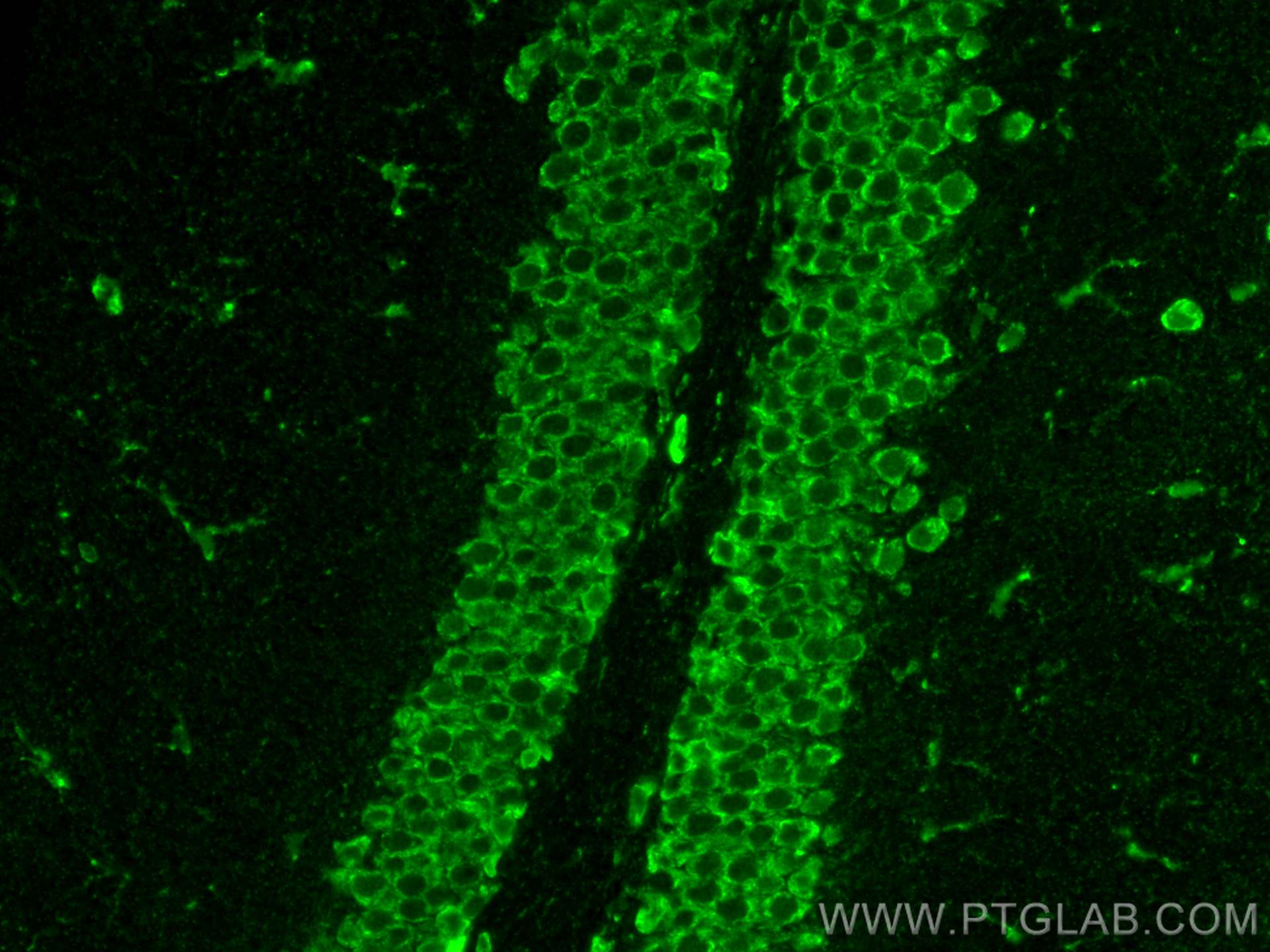 IF Staining of mouse brain using 30851-1-AP