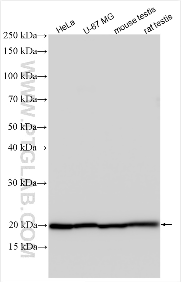 WB analysis using 30851-1-AP