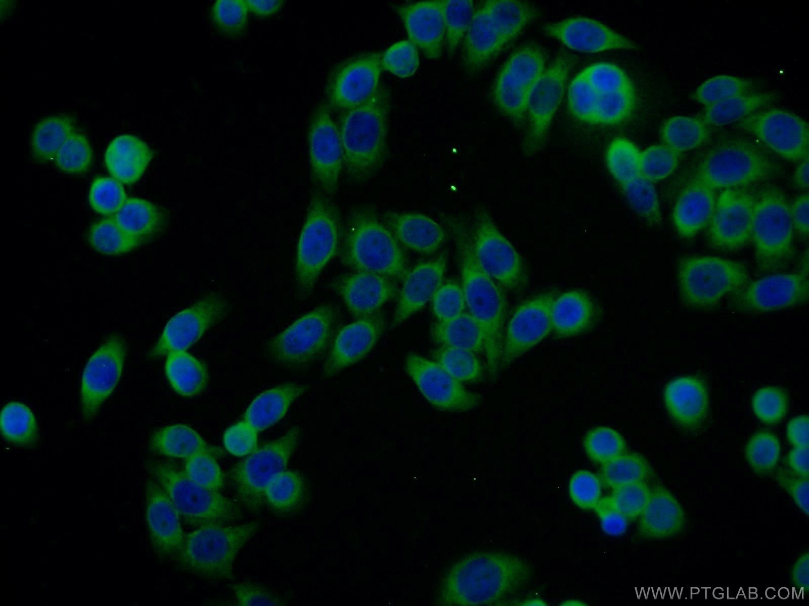 IF Staining of HeLa using 11655-2-AP