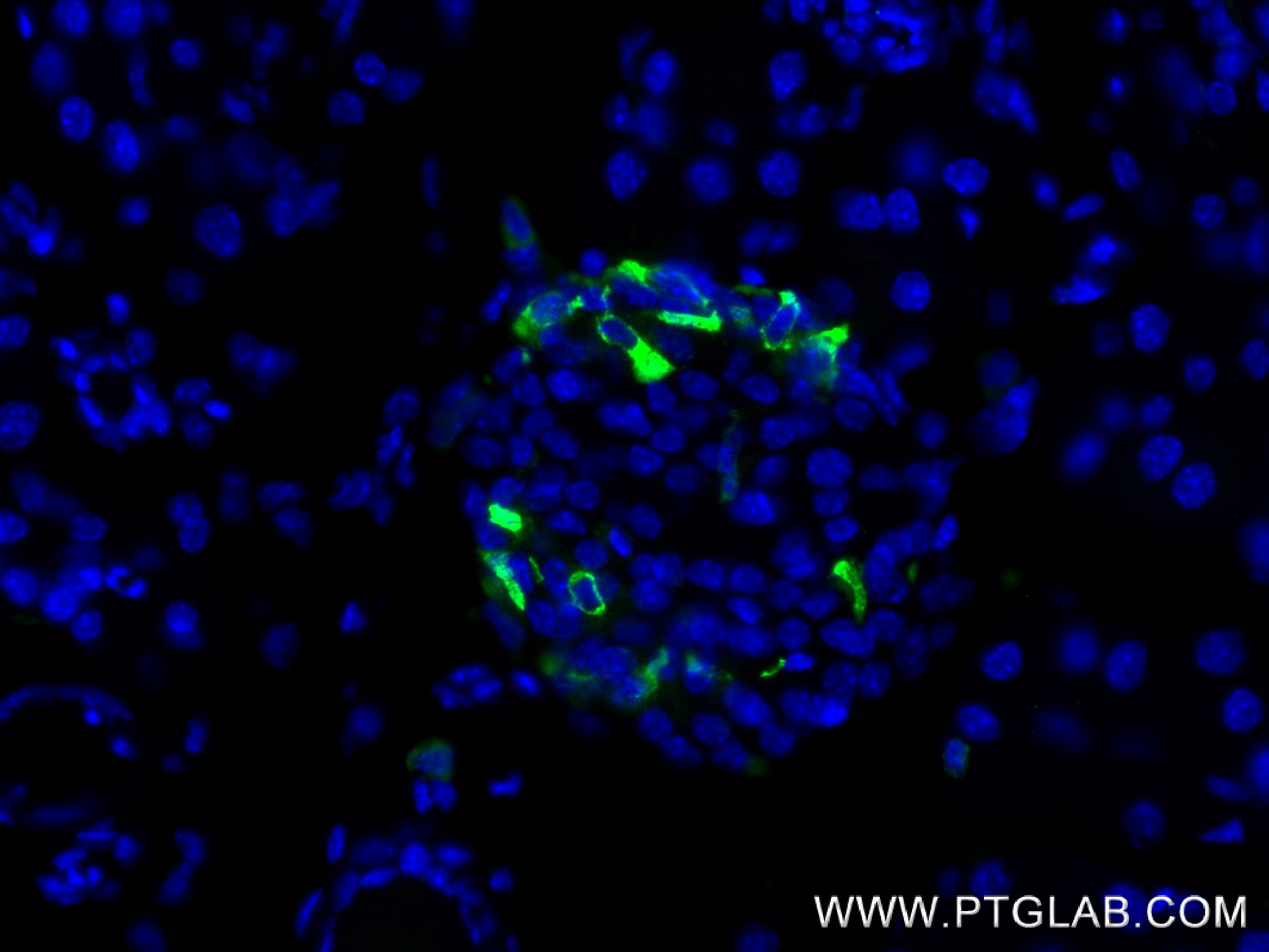 IF Staining of mouse pancreas using 84351-1-RR