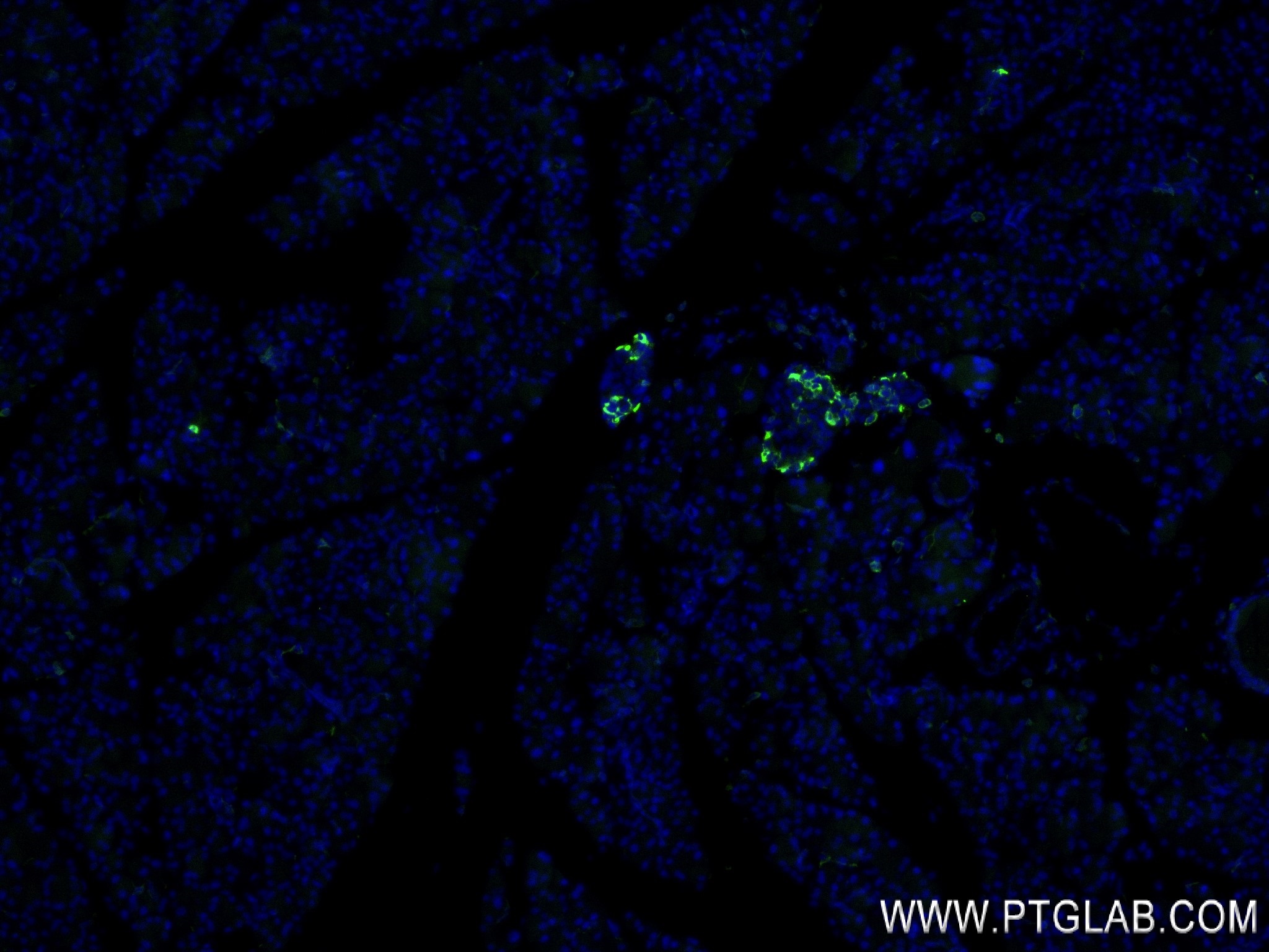 IF Staining of mouse pancreas using 84351-1-RR