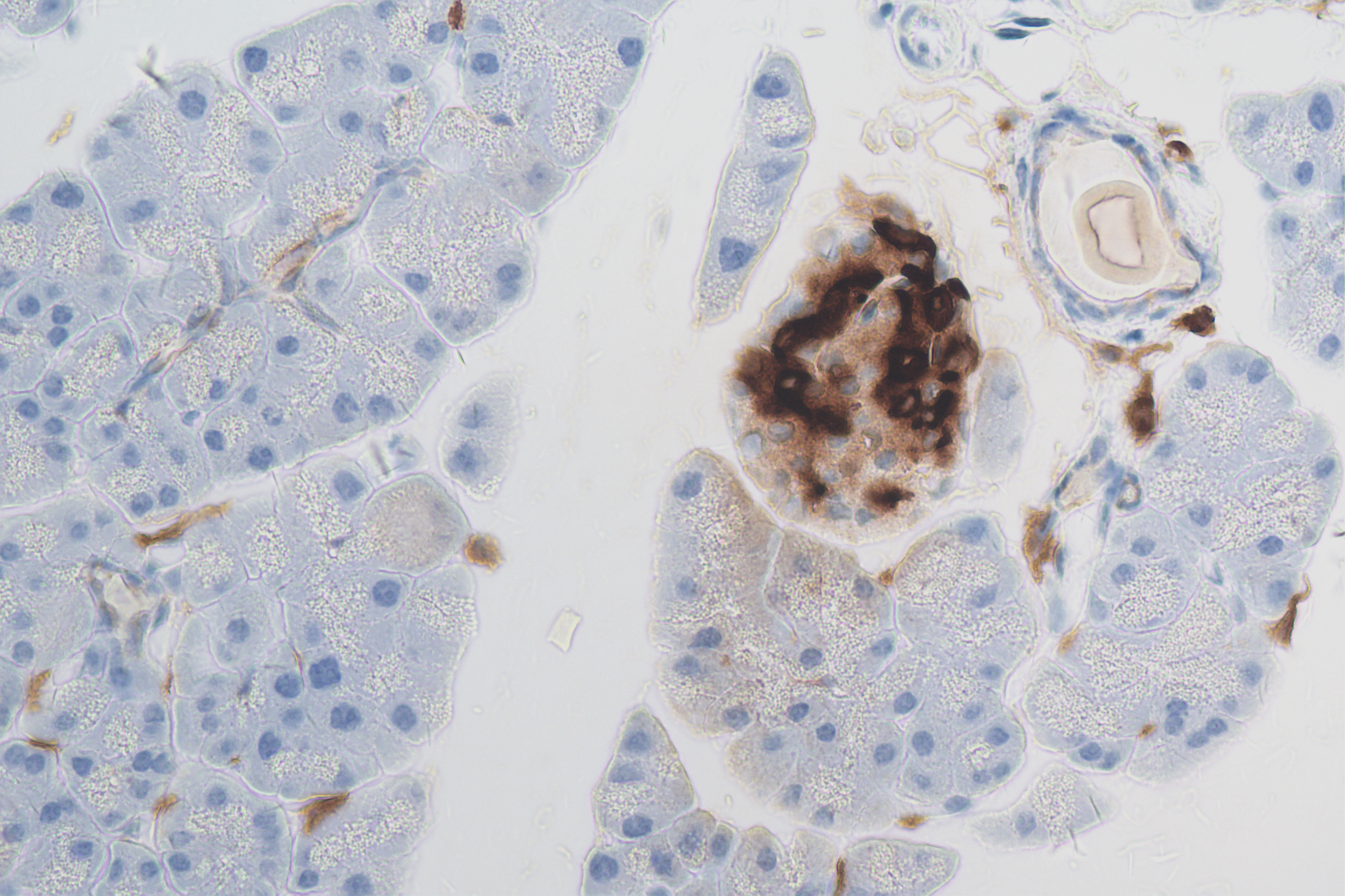 IHC staining of mouse pancreas using 84351-1-RR