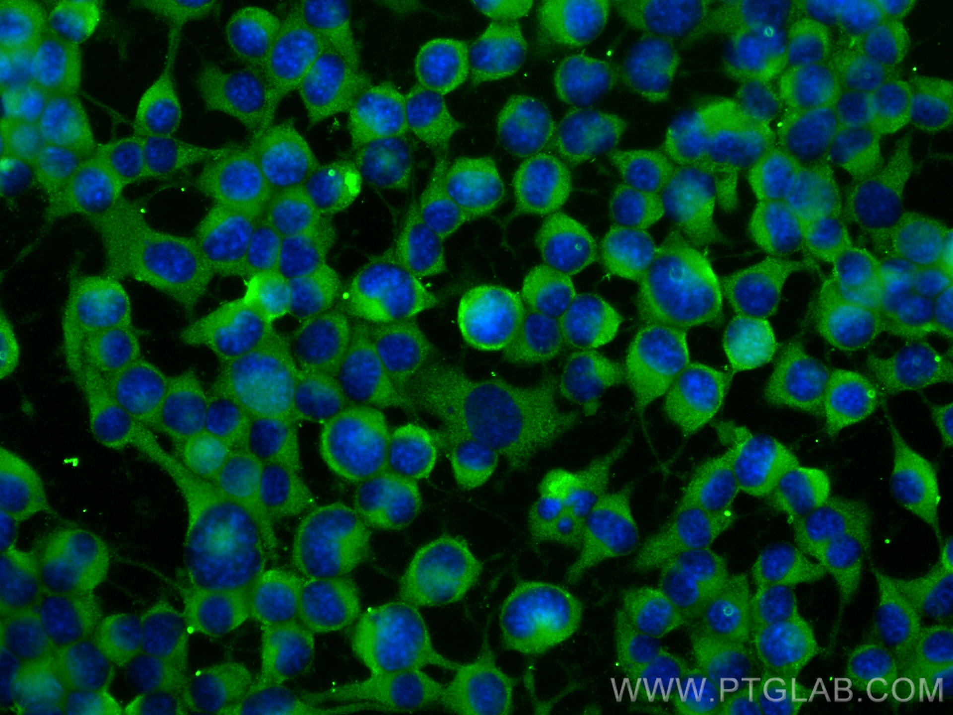 IF Staining of Neuro-2a using 20404-1-AP