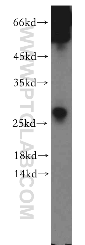 WB analysis of human testis using 12401-1-AP