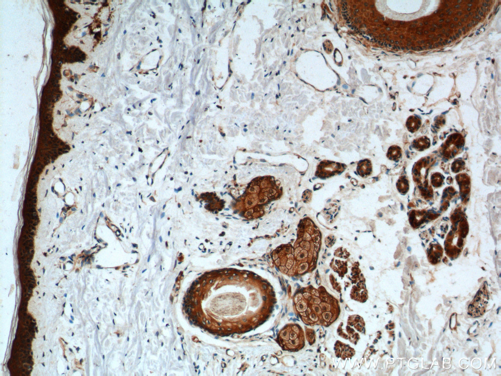 IHC staining of human skin using 24925-1-AP