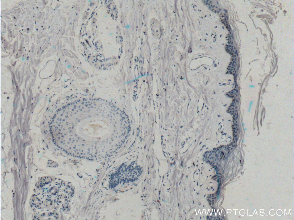 IHC staining of human skin using 15363-1-AP