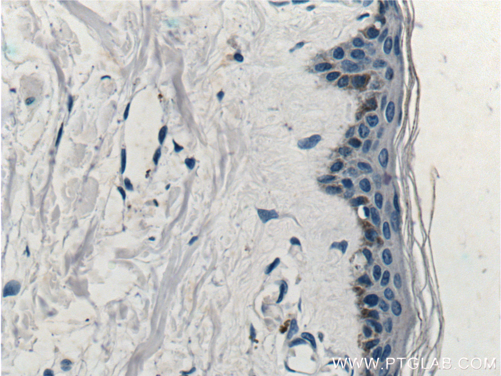 IHC staining of human skin using 15363-1-AP