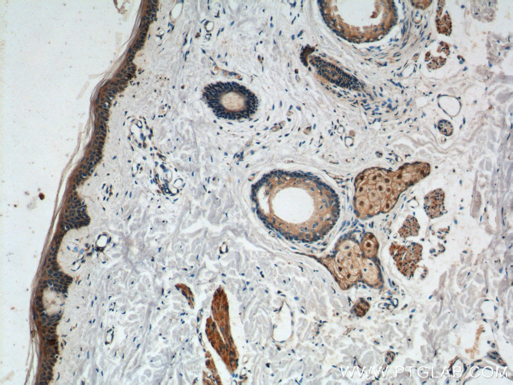 IHC staining of human skin using 24918-1-AP