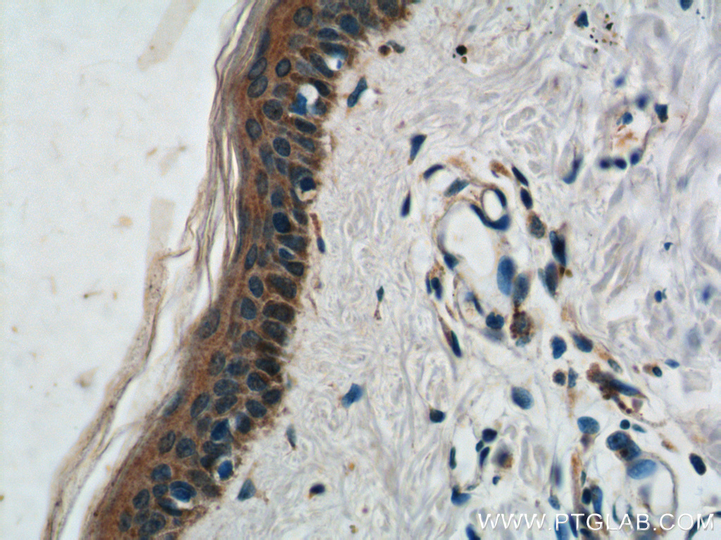 IHC staining of human skin using 24918-1-AP