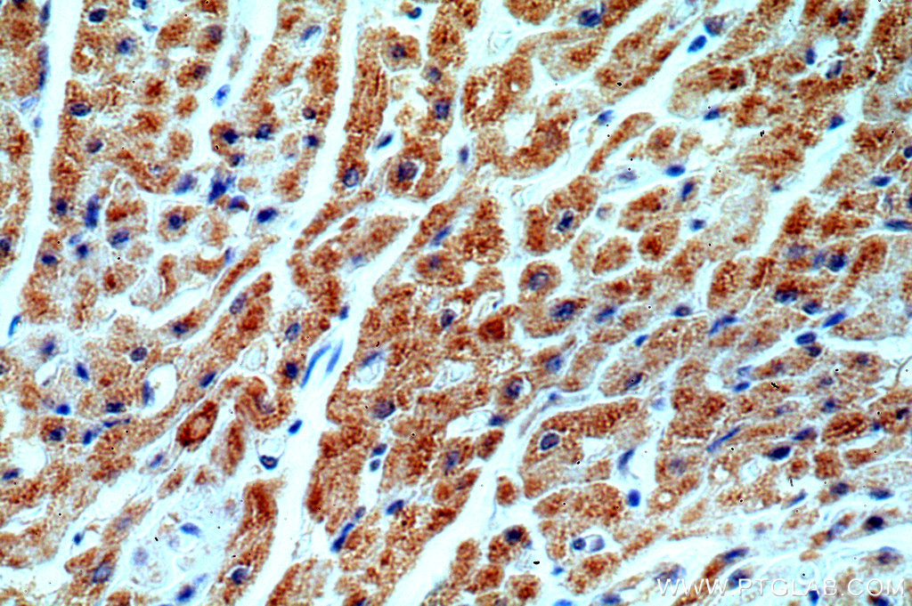 IHC staining of human heart using 19736-1-AP