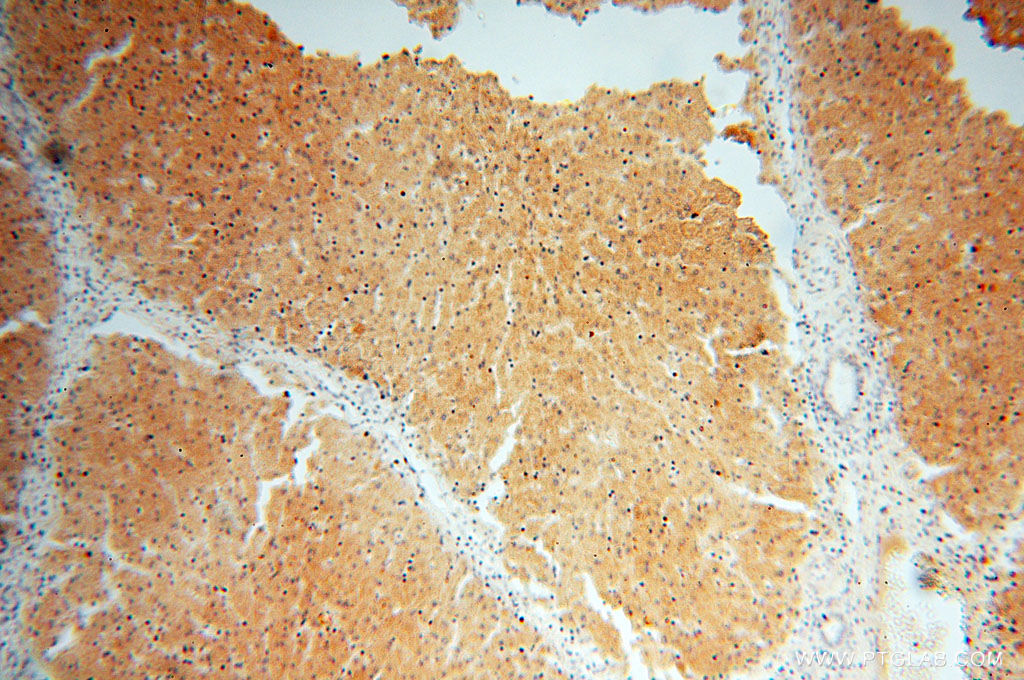 IHC staining of human liver using 18004-1-AP