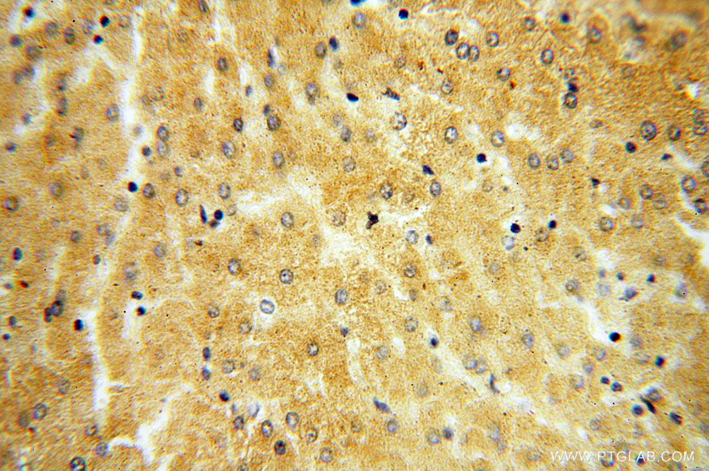 IHC staining of human liver using 18004-1-AP