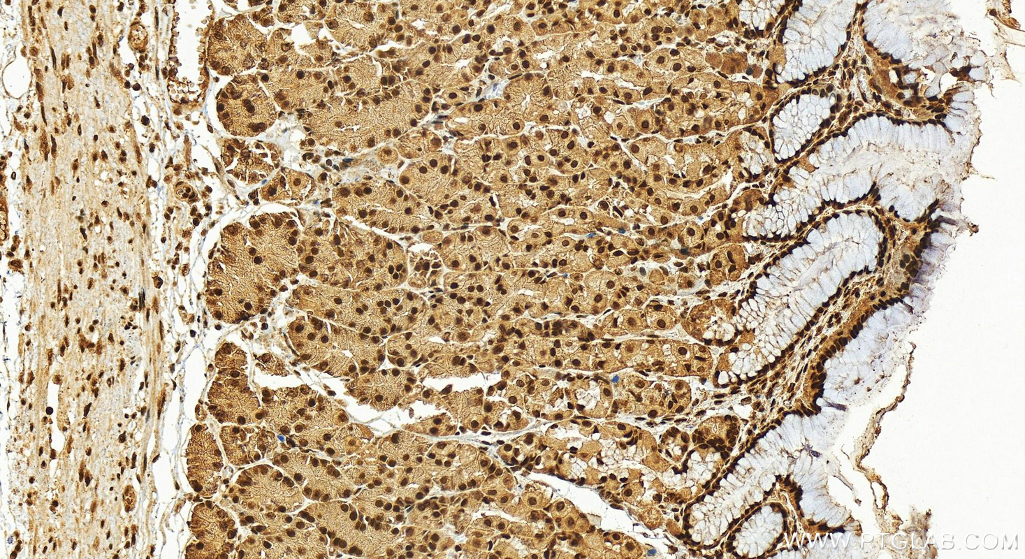 IHC staining of human stomach using 14015-1-AP