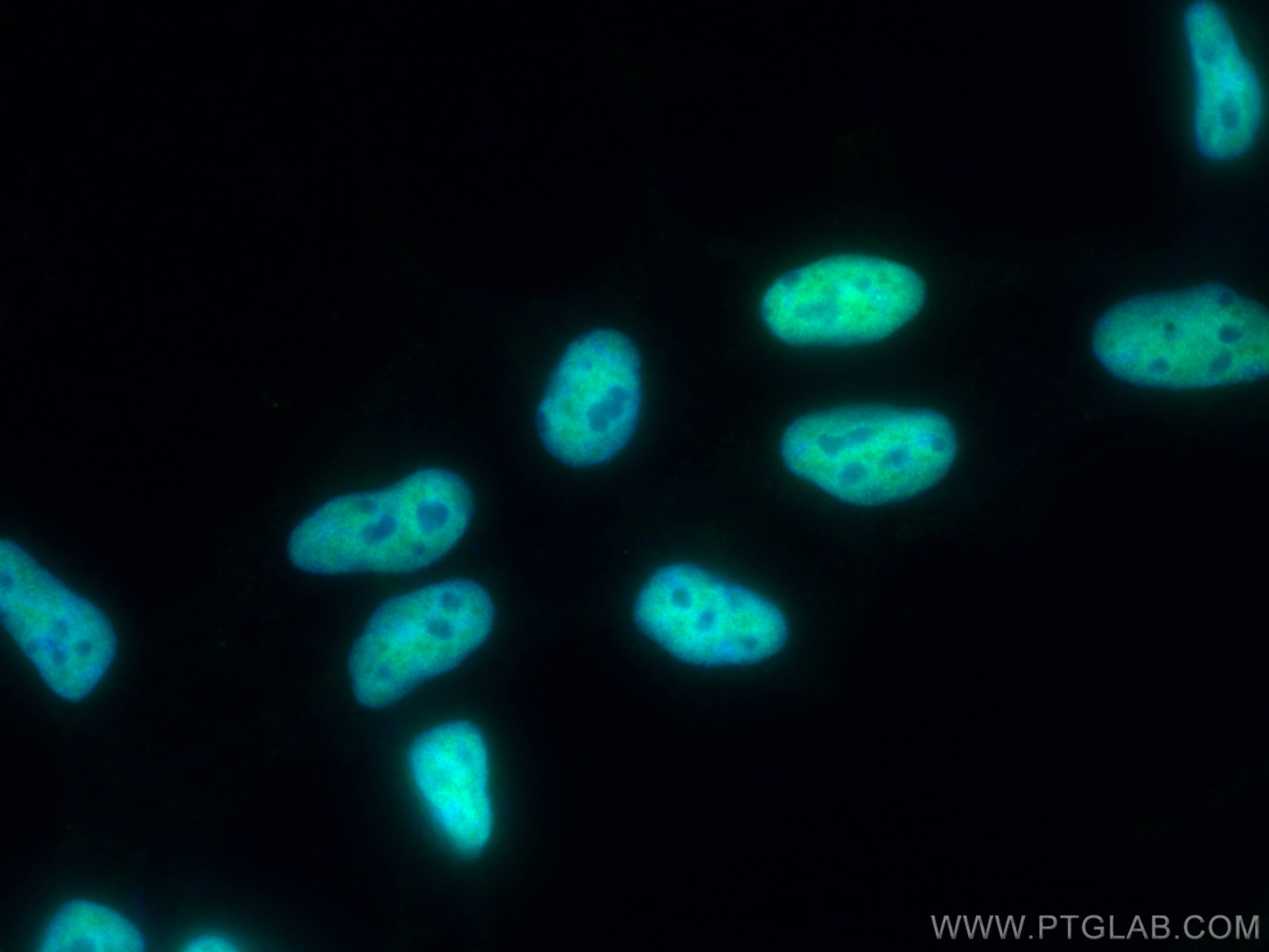 IF Staining of HEK-293 using 19837-1-AP