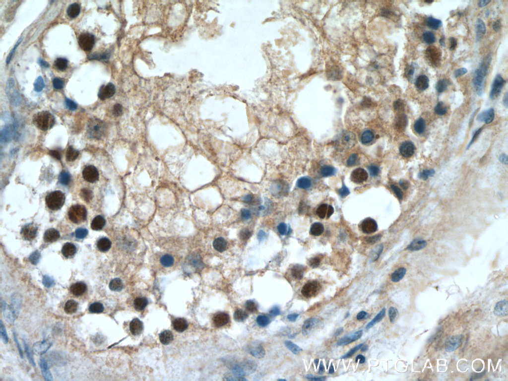 IHC staining of human testis using 23314-1-AP