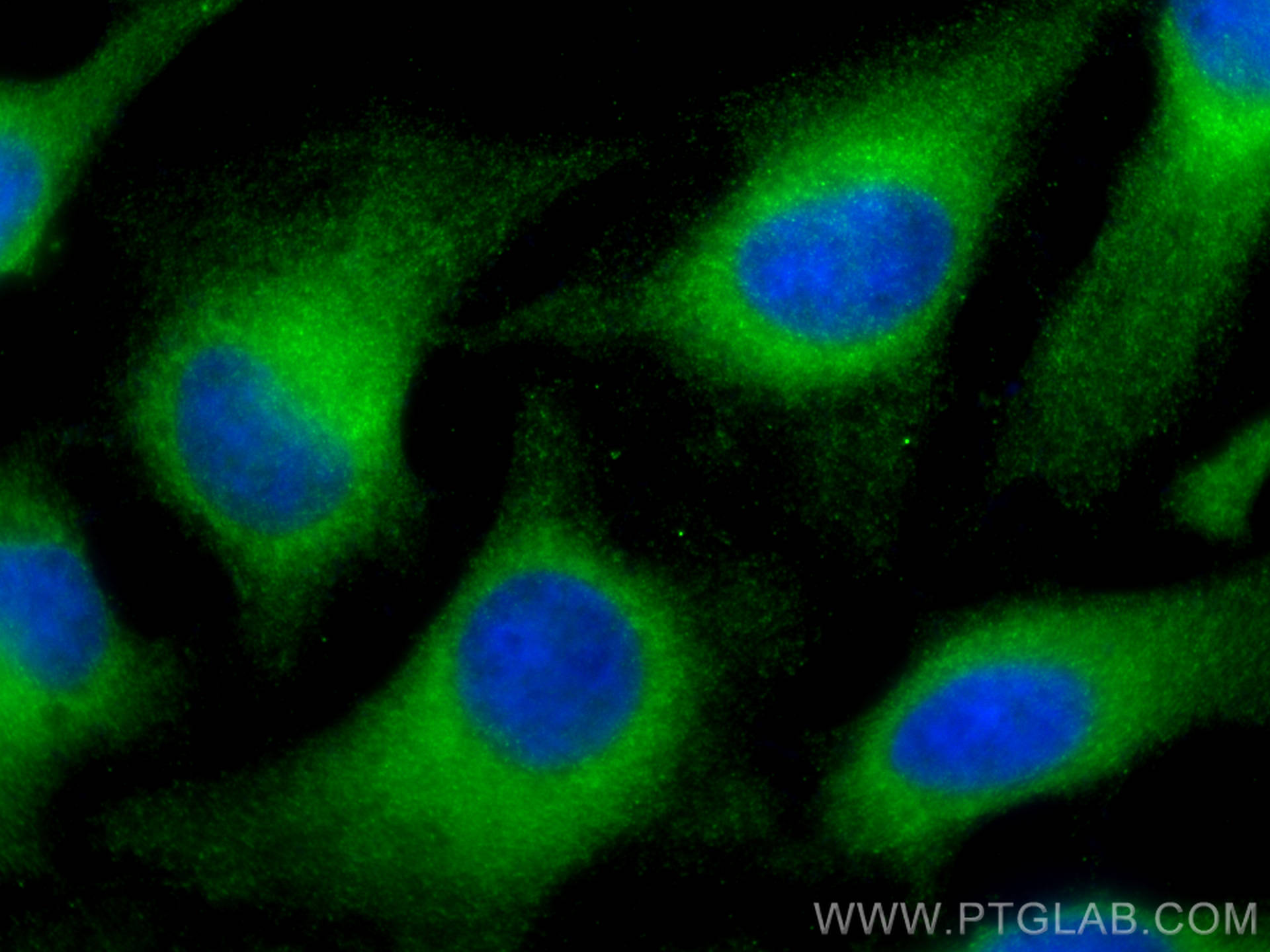 IF Staining of HeLa using 13009-1-AP